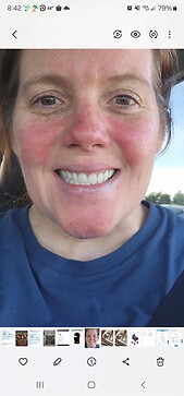 My face looks like this mostly all the time.